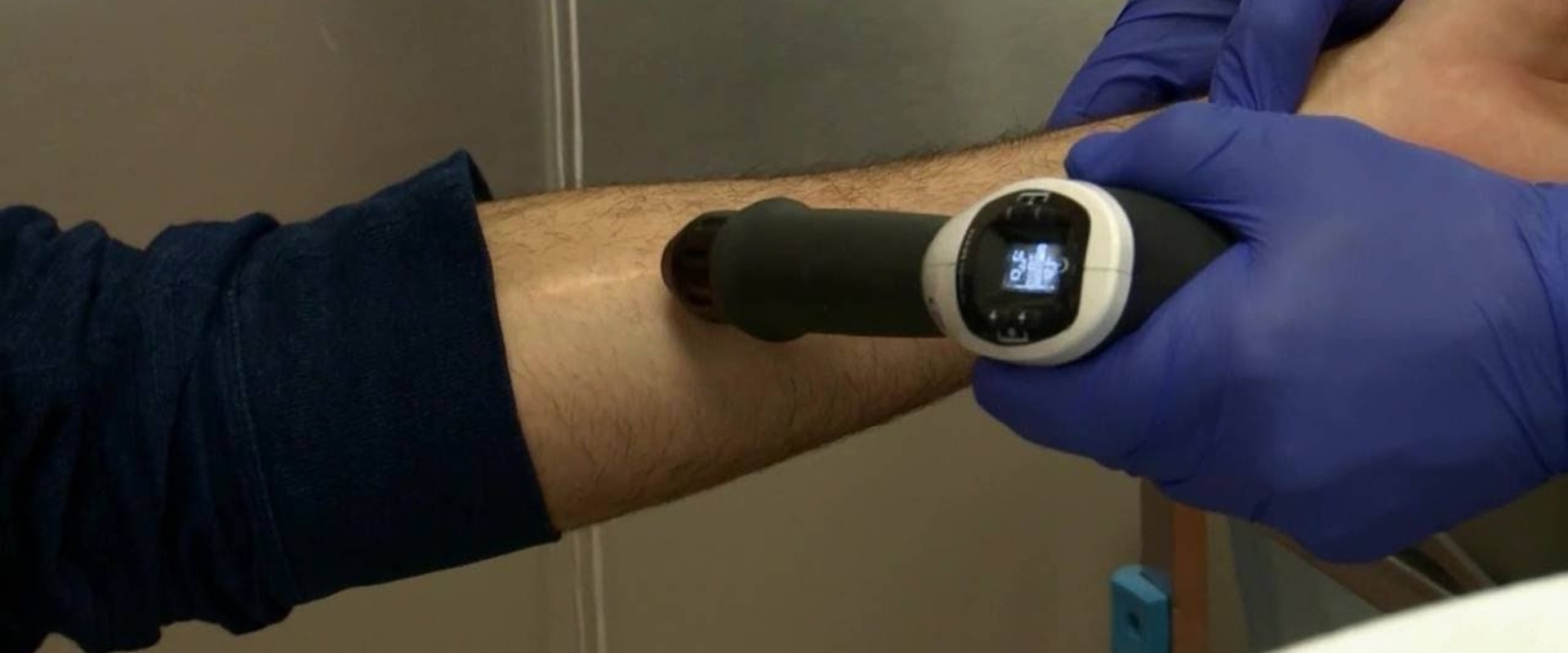 Does shock wave therapy for ed work?