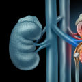 What is the fastest way to dissolve a kidney stone?