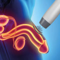 How many sessions of shockwave therapy for erectile dysfunction?