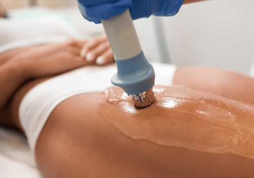 What is shockwave therapy for hip tendonitis?