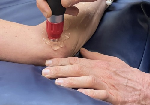 What to expect after shock wave therapy?