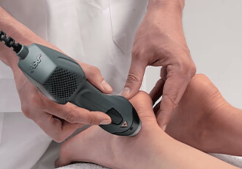 Should you ice after shockwave?