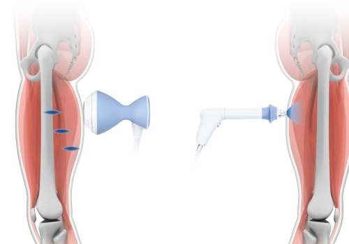 How do shock waves affect humans?