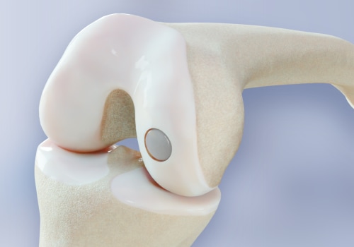 What is the new device that eliminates years of knee pain?